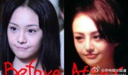 爆料大咖整容视频,整容前后惊人对比，视频曝光引发热议