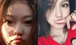 爆料小猪整容视频大全集,视频大全集深度解析